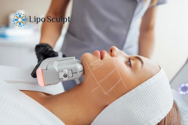 HIFU vs Botulinum Toxin: Understanding the Differences 1 HIFU vs Botox Merseyside What is the best option for you?