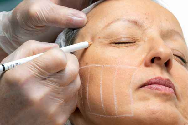 CryoPen: 5 Skin Concerns It May Be Used to Treat 4 What should you ask before having CryoPen treatment Merseyside?